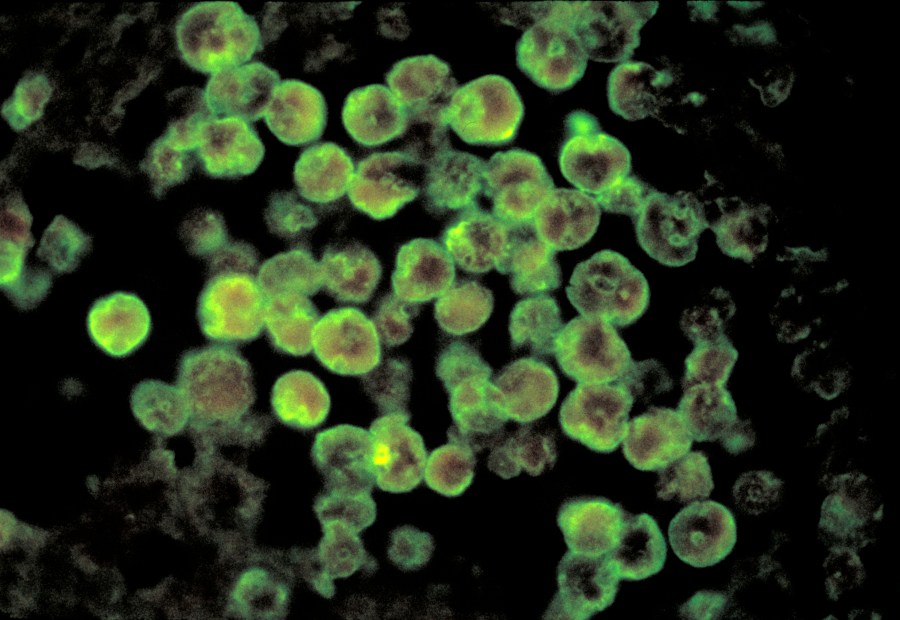 Naegleria fowleri