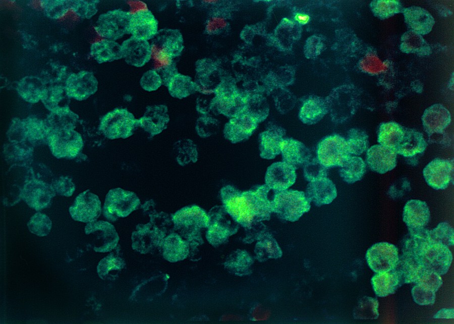 Naegleria fowleri